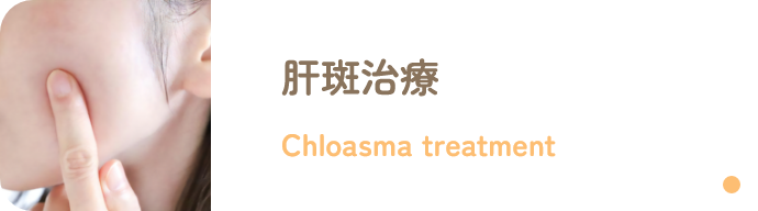 肝斑治療