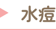 水痘