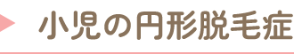 小児の円形脱毛症